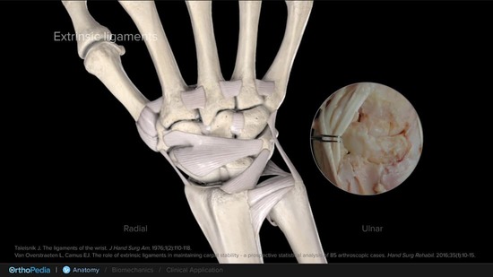 Open Anatomy of the Wrist With Scapholunate Ligament Injury : OrthoPedia