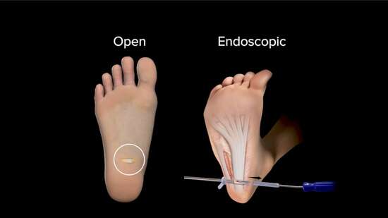 ugg black platform sandals