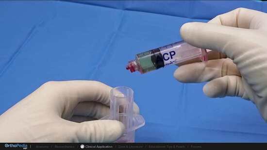 Technician Setup for ACP : OrthoPedia Vet