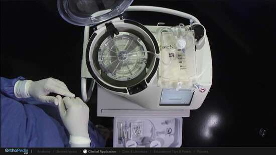 Troubleshooting the Angel® System: Proper Disposable Set Loading ...