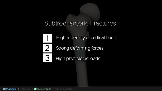 Biomechanics of the Proximal Femur With Subtrochanteric Fractures ...