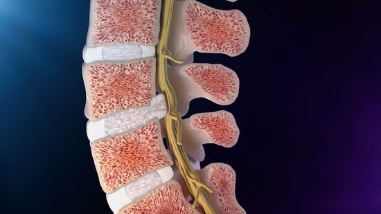 Herniated Disc : OrthoPedia Patient