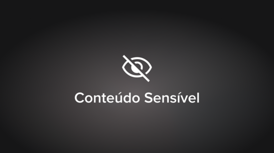 Artrite do Tornozelo: Abordagem Minimamente Invasiva Para Fusão do ...
